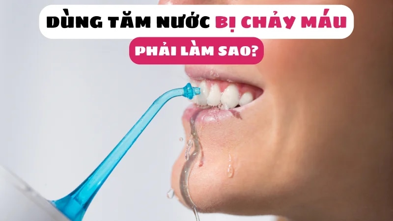 dung-tam-nuoc-bi-chay-mau-phai-lam-sao-article-1