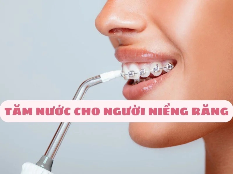 tam-nuoc-cho-nguoi-nieng-rang-lua-chon-hoan-hao-1